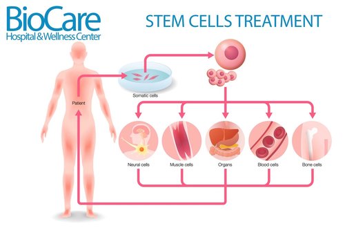 Stem Cell Treatments